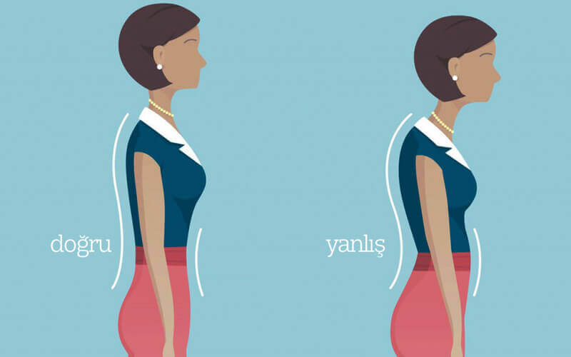 Duruş bozukluğu nedir ?